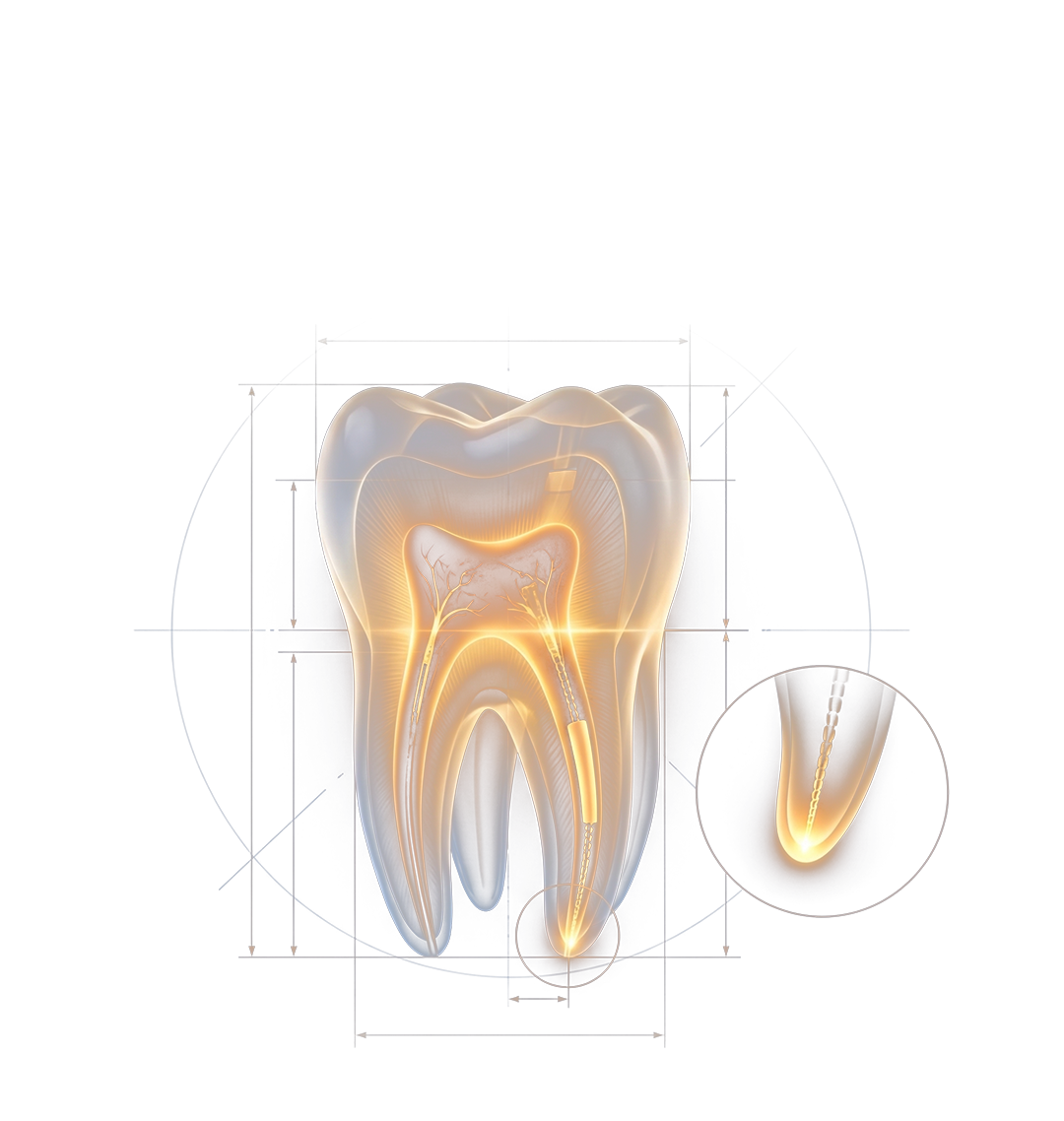 Root Canal Treatment