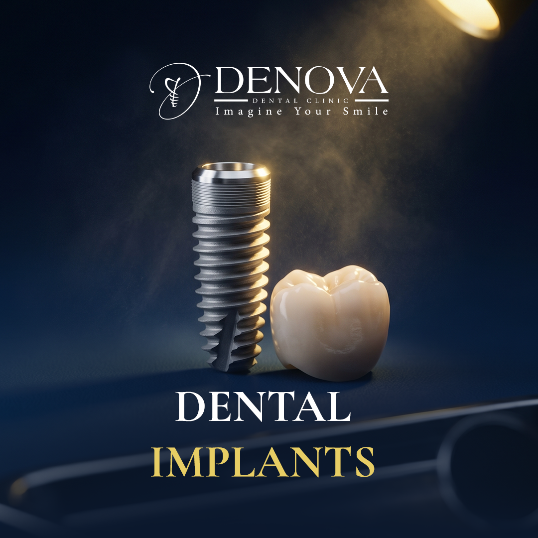 Dental Implants