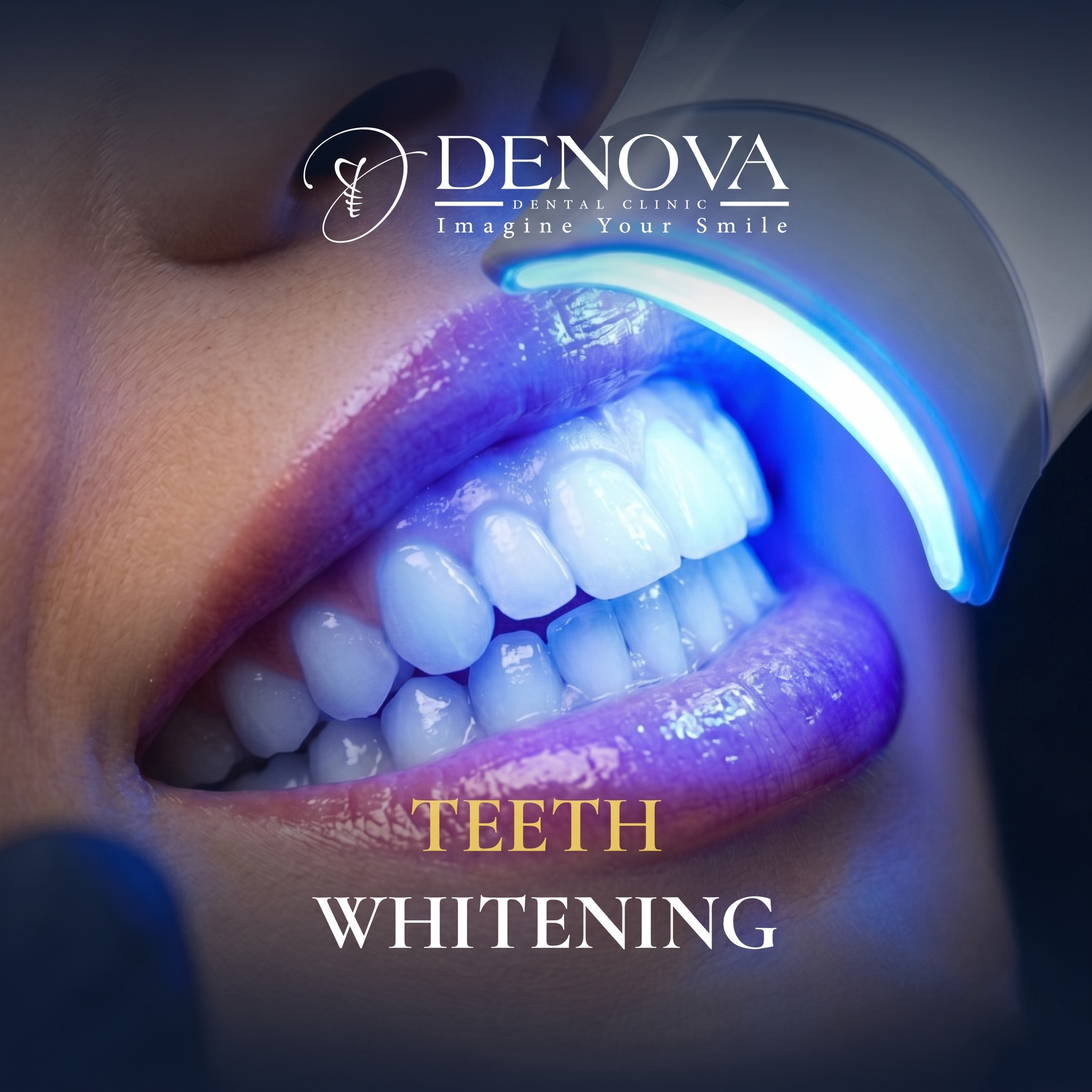 Teeth Whitening